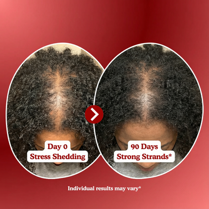 RRB Hair Growth Acceleration Gummies