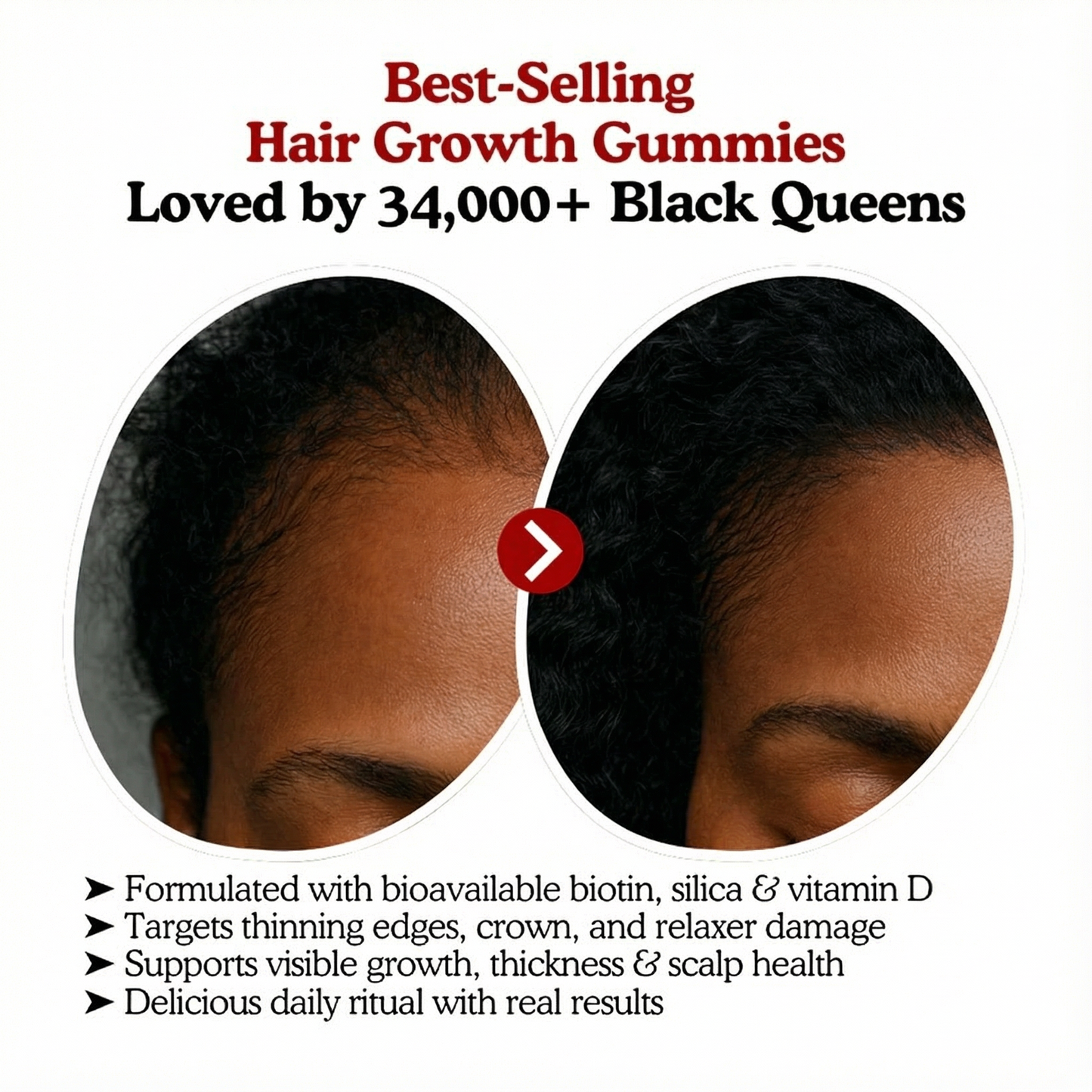 RRB Hair Growth Acceleration Gummies