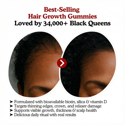 RRB Hair Growth Acceleration Gummies