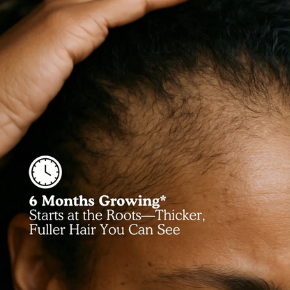 RRB Hair Growth Acceleration Gummies